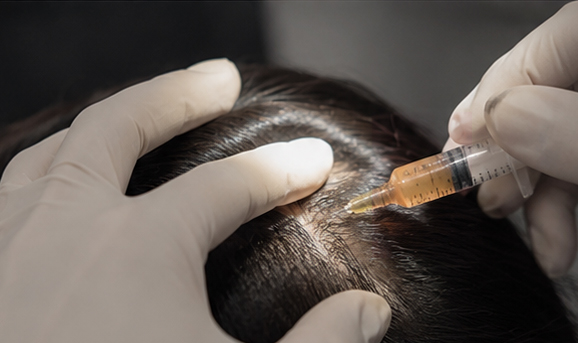 SCALP 프로그램